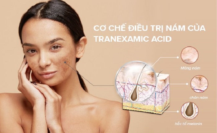 Theo các nghiên cứu thực tiễn, Acid Tranexamic luôn cho kết quả tích cực Theo các nghiên cứu thực tiễn, Acid Tranexamic luôn cho kết quả tích cực