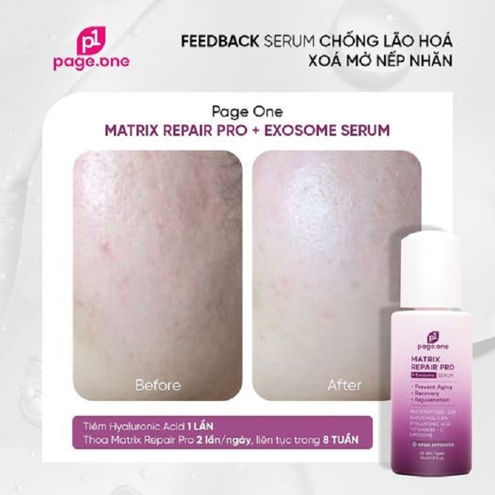 Hiệu quả sử dụng serum chống lão hóa PageOne thật "vi diệu" chỉ sau 6 tuần sử dụng liên tục Hiệu quả sử dụng serum chống lão hóa PageOne thật "vi diệu" chỉ sau 6 tuần sử dụng liên tục