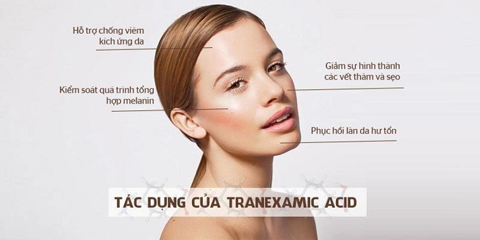 Tranexamic Acid không chỉ có tác dụng ức chế quá trình tổng hợp melanin ngăn ngừa nán sạm mà còn mang lại nhiều lợi ích khác cho làn da Tranexamic Acid không chỉ có tác dụng ức chế quá trình tổng hợp melanin ngăn ngừa nán sạm mà còn mang lại nhiều lợi ích khác cho làn da