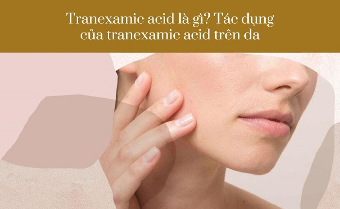 Hoạt chất Tranexamic Acid là gì? Tại sao được sử dụng phổ biến trong các sản phẩm trị nám làm trắng da Hoạt chất Tranexamic Acid là gì? Tại sao được sử dụng phổ biến trong các sản phẩm trị nám làm trắng da