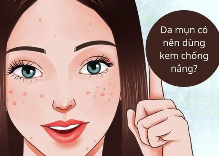 Bảo vệ da mụn với kem chống nắng phù hợp 