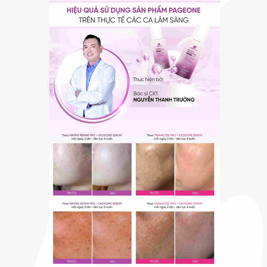 Serum Phục Hồi Chuyên Sâu Chống Lão Hóa Page One Matrix Repair Pro + Exosome 