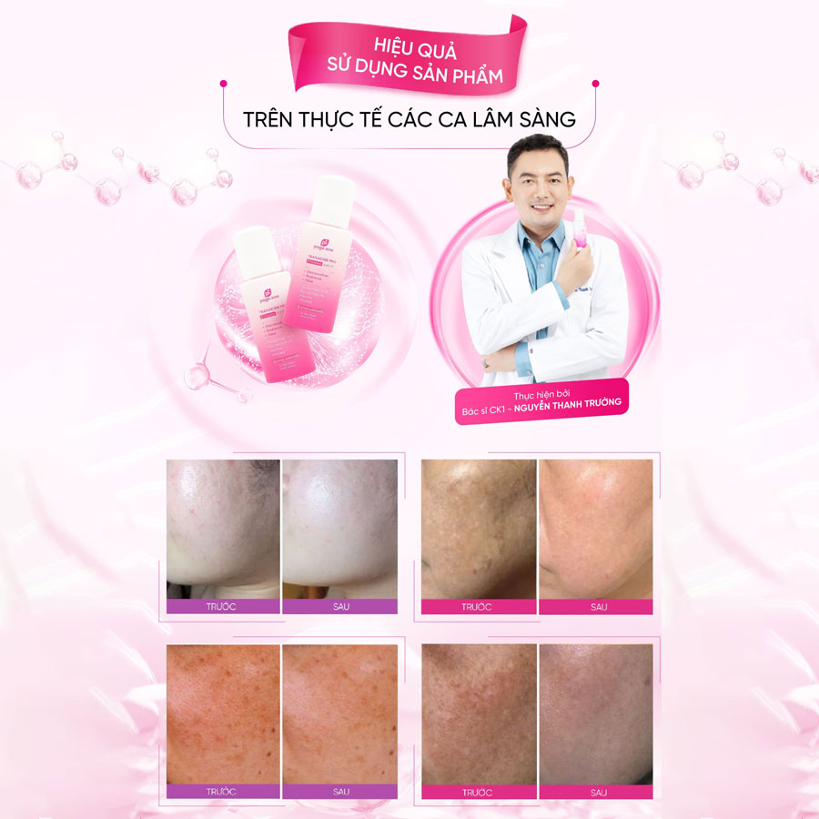 Serum Dưỡng sáng Làm mờ Thâm Nám Page One Tranacide Pro + Exosome 